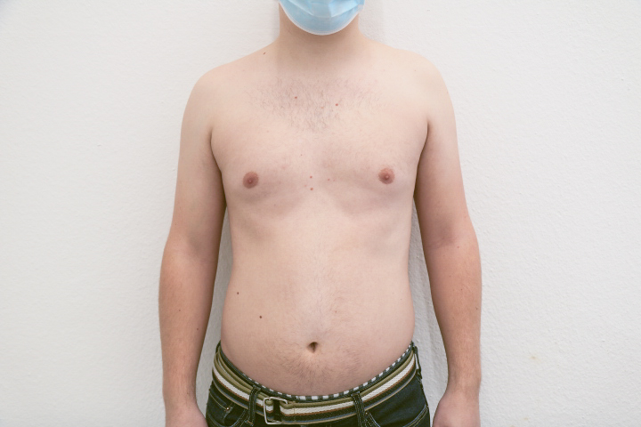 Body Toning Results