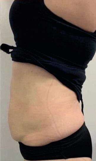 Combination Therapy Results