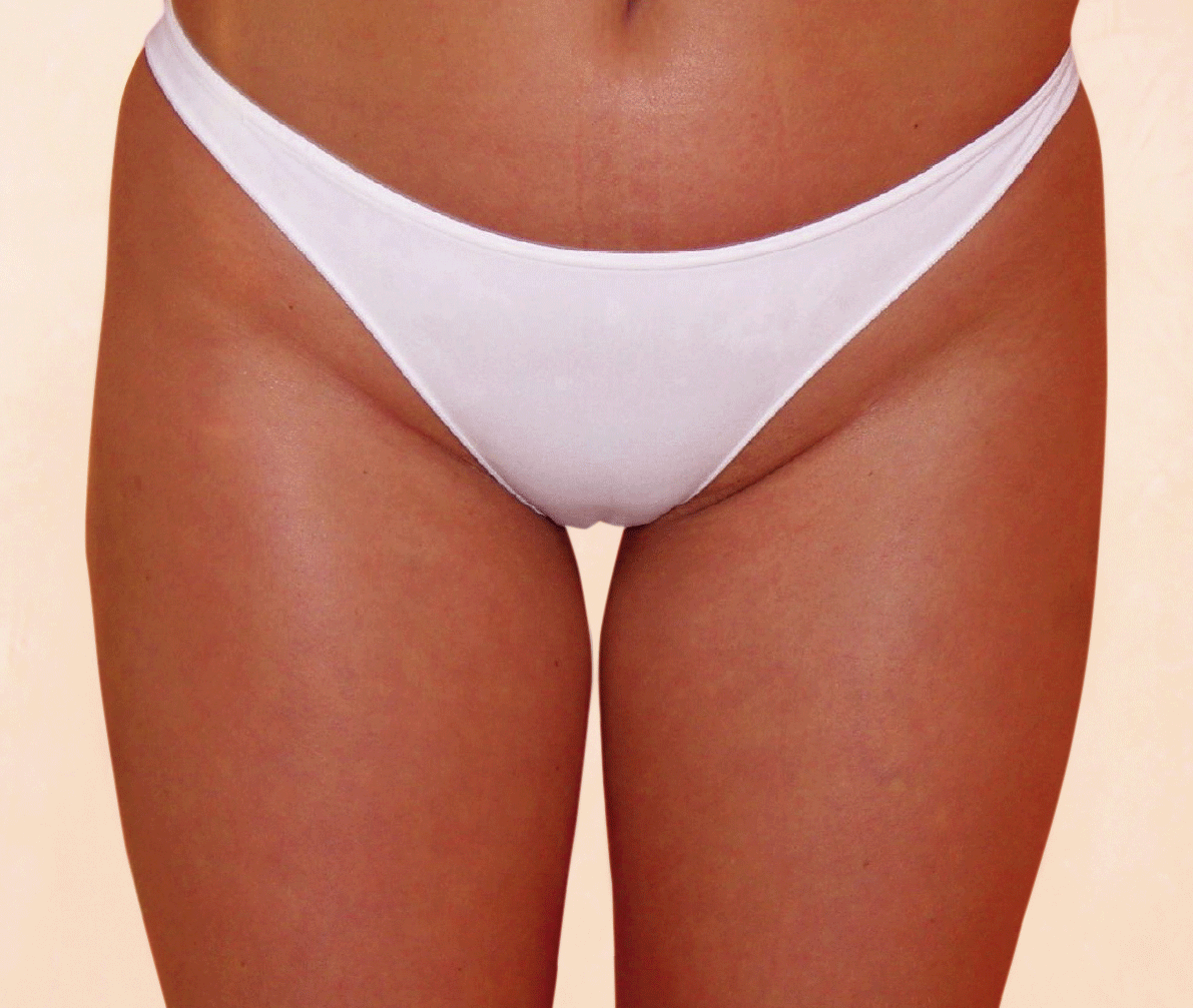 Skin Firming Results