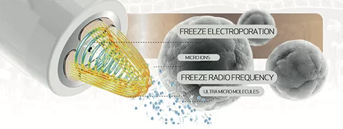 Radiofrequency + Cryo